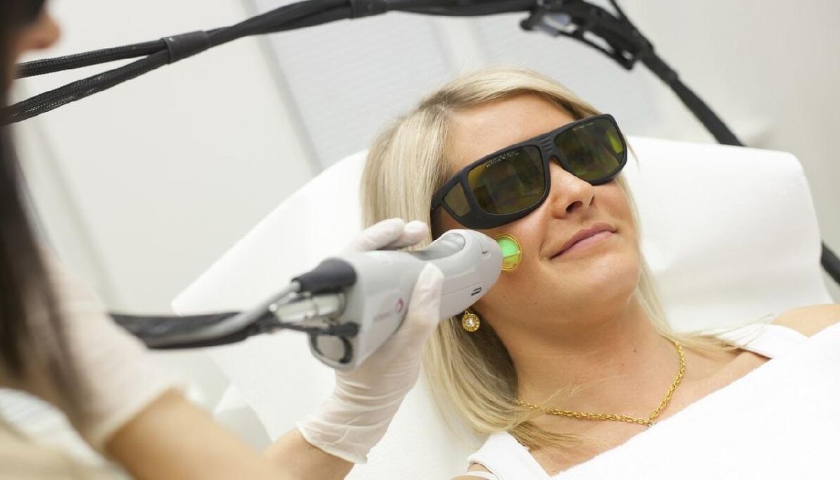 Laserverjüngung